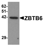 ZBTB6 Antibody