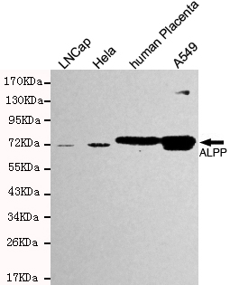 Placental alkaline phosphatase