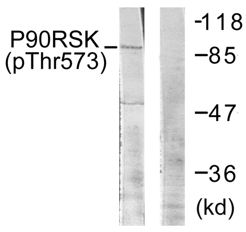 p90 RSK (Phospho-Thr573) Antib