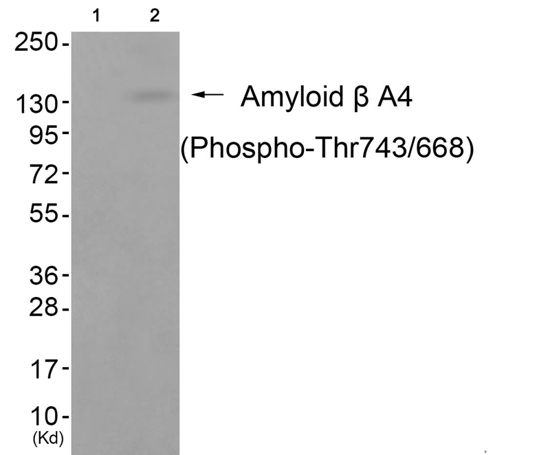 Amyloid β A4 (Phospho-Thr743/6