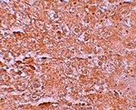 ZIP14 Antibody