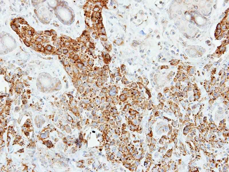Pancreatic Lipase antibody