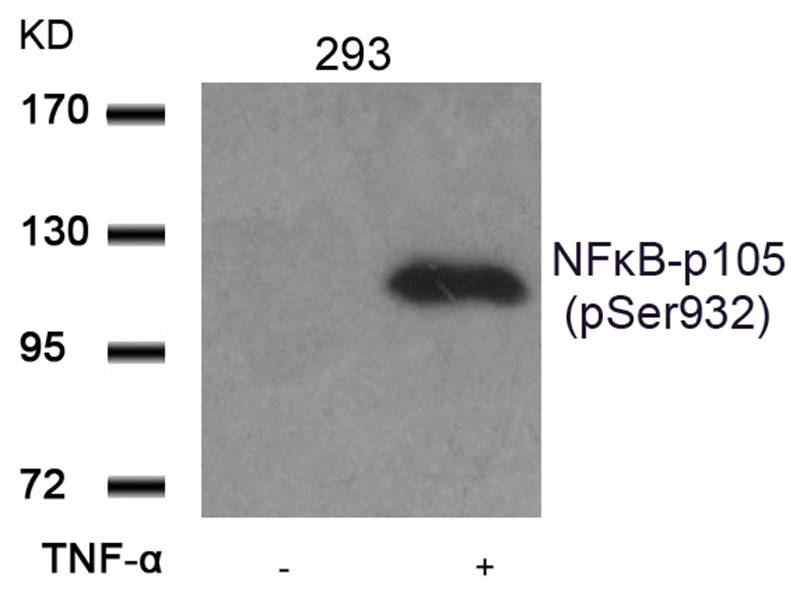 NFkB-p105(Phospho-Ser932) Anti