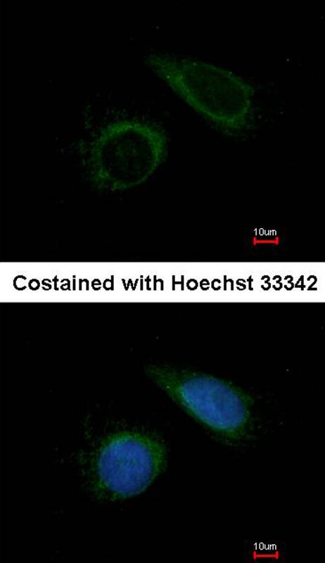 COX6B1 antibody