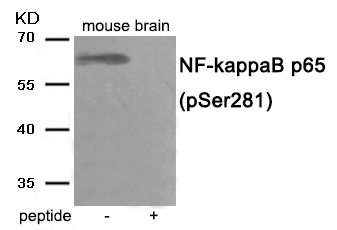 NF- kappaB p65 (Phospho-Ser281