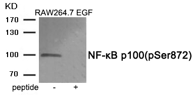 NF-κB p100 (Phospho-Ser872) An