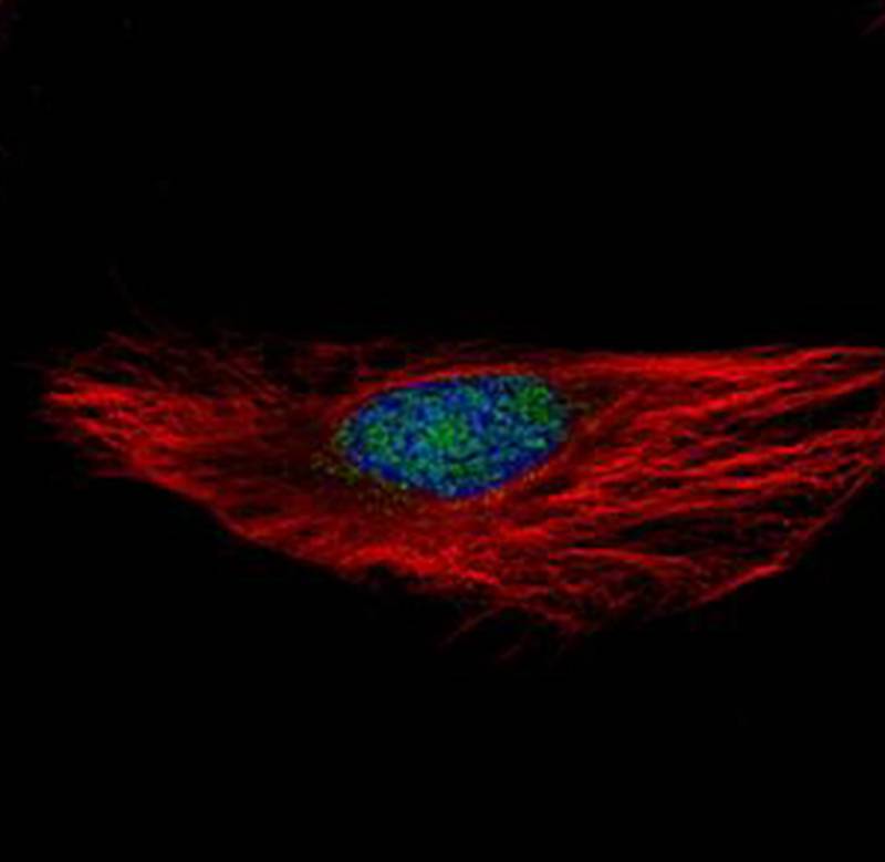 RNA binding motif protein 28 a