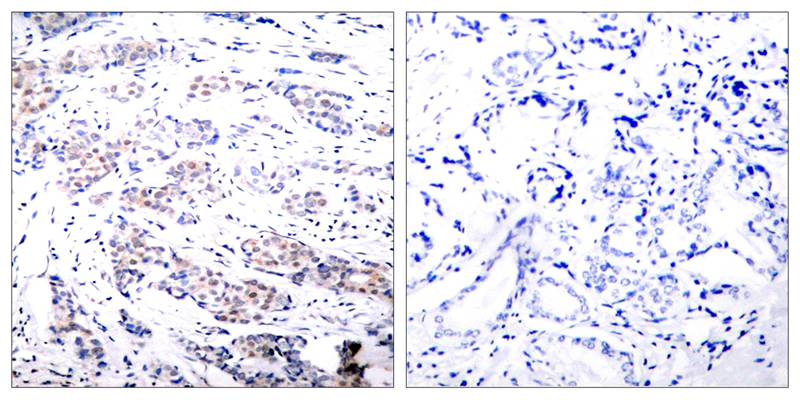 Elk-1  Antibody