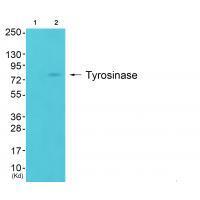 Tyrosinase Antibody