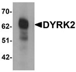 DYRK2 Antibody