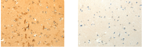 CFHR1 Antibody