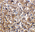 IRAK-M Antibody