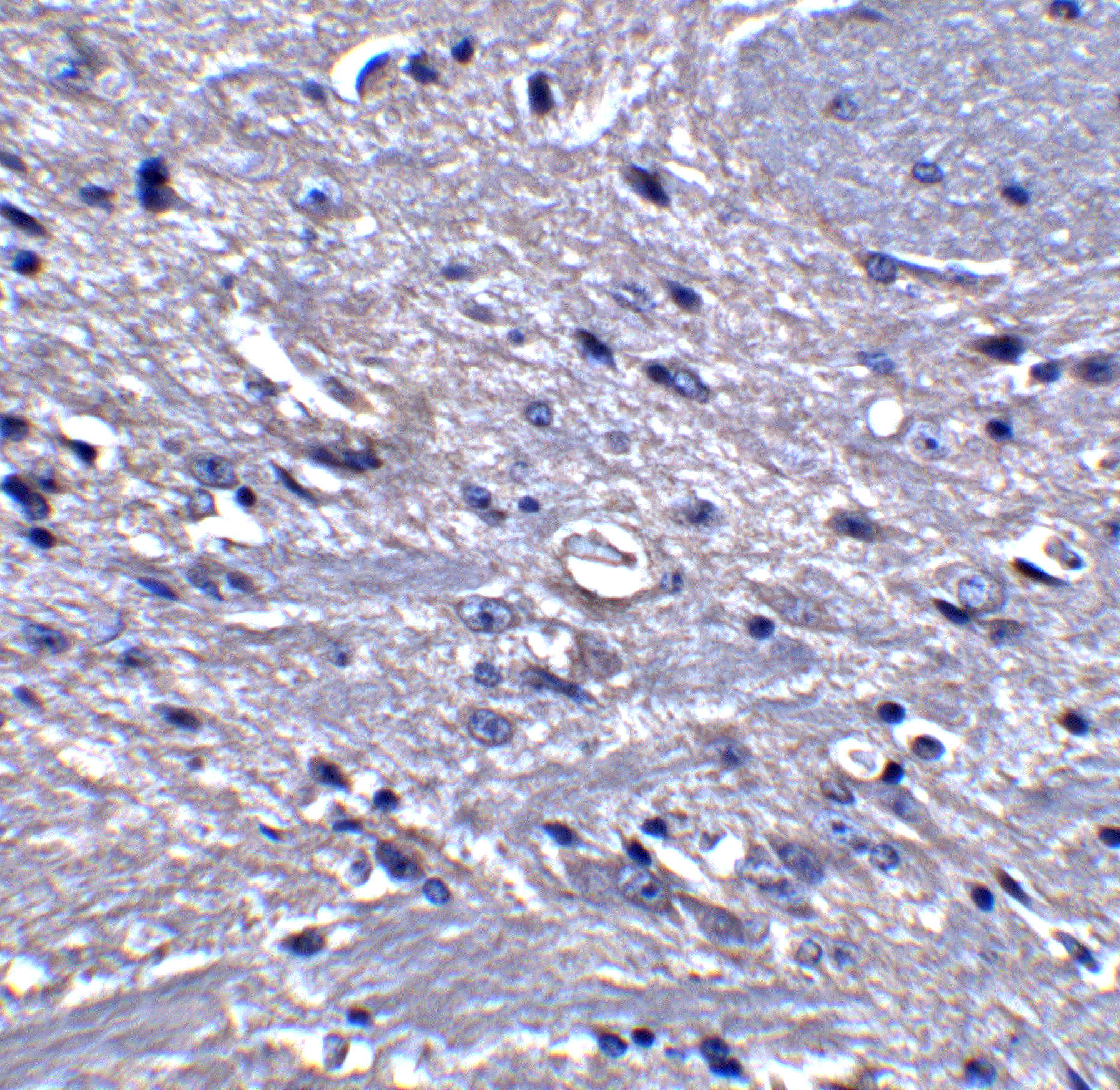 GPAT1 Antibody