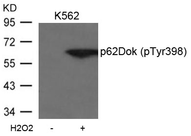 p62Dok(phospho-Tyr398) Antibod