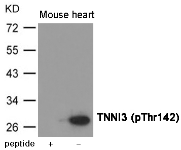 TNNI3 (Phospho-Thr142) Antibod