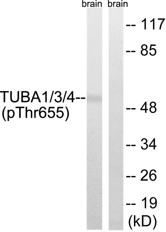 TUBA1/3/4 (Phospho-Tyr272) Ant