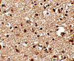 JPH4 Antibody