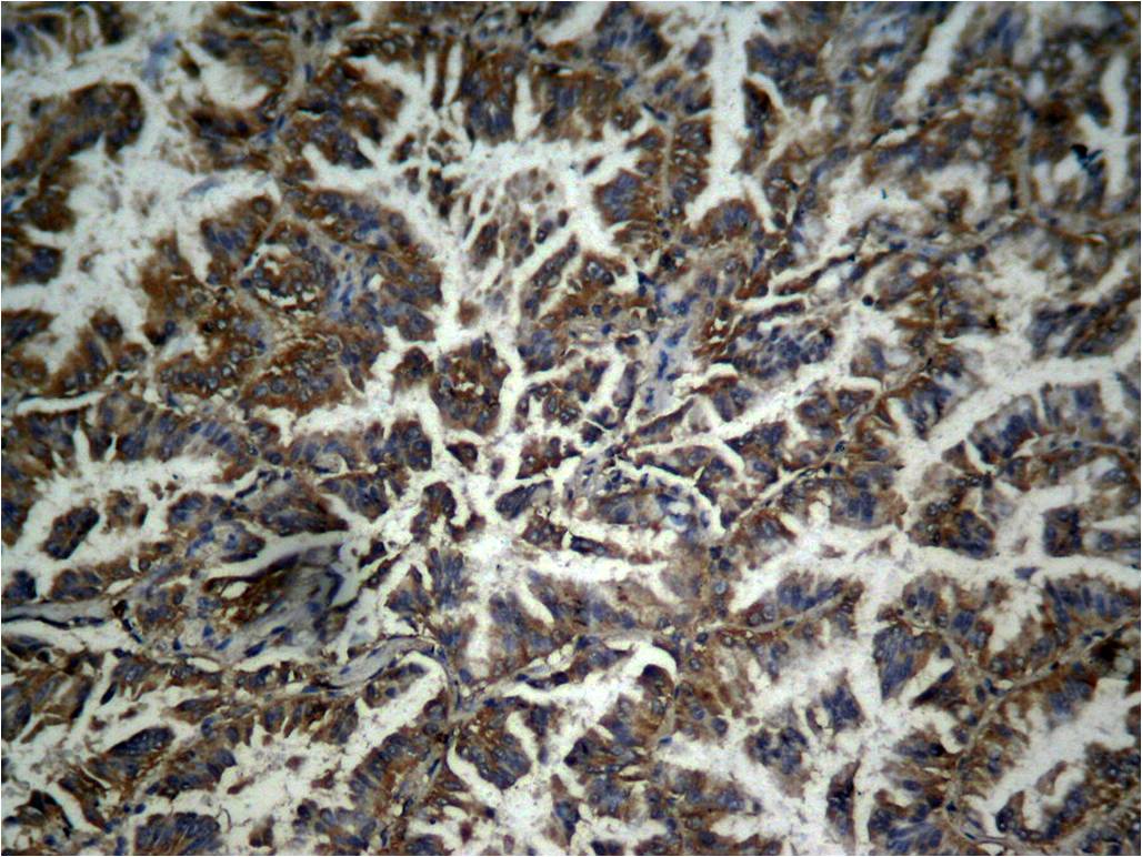 β-catenin(phospho-Tyr333) Anti