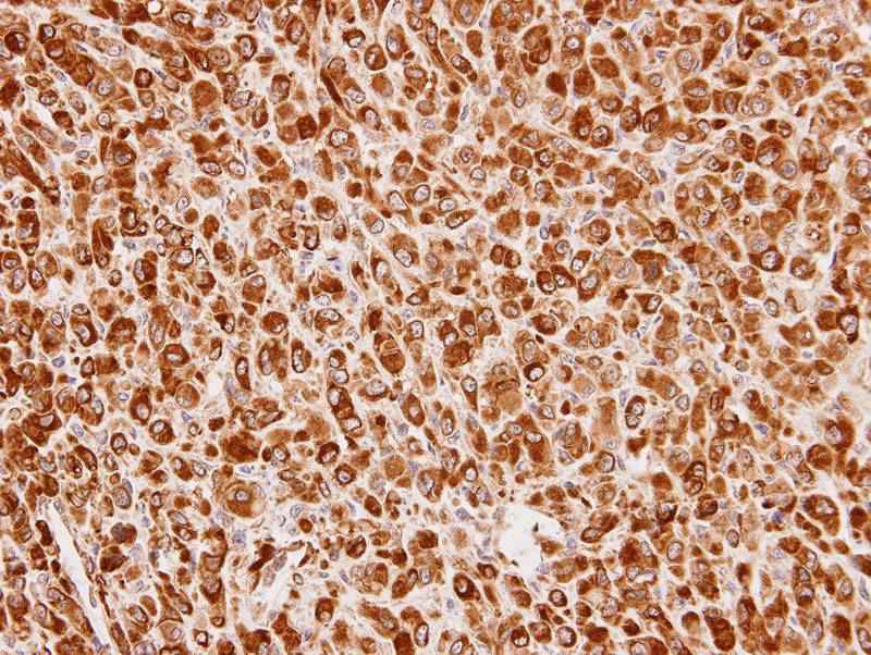Cullin-7 antibody
