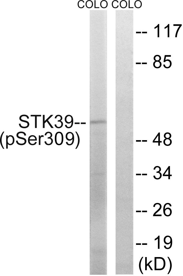 STK39 (Phospho-Ser309) Antibod
