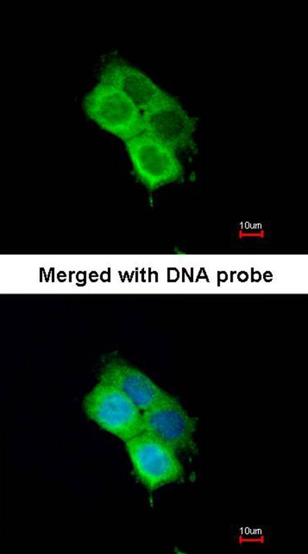 OXSR1(OSR1) antibody