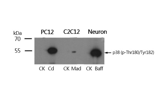 P38 MAPK(Phospho-Thr180/Tyr182