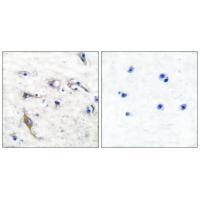 JM4 Antibody