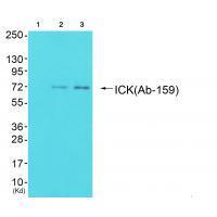 ICK Antibody