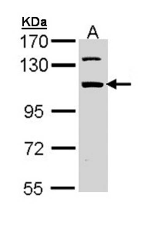 RNA binding motif protein 28 a