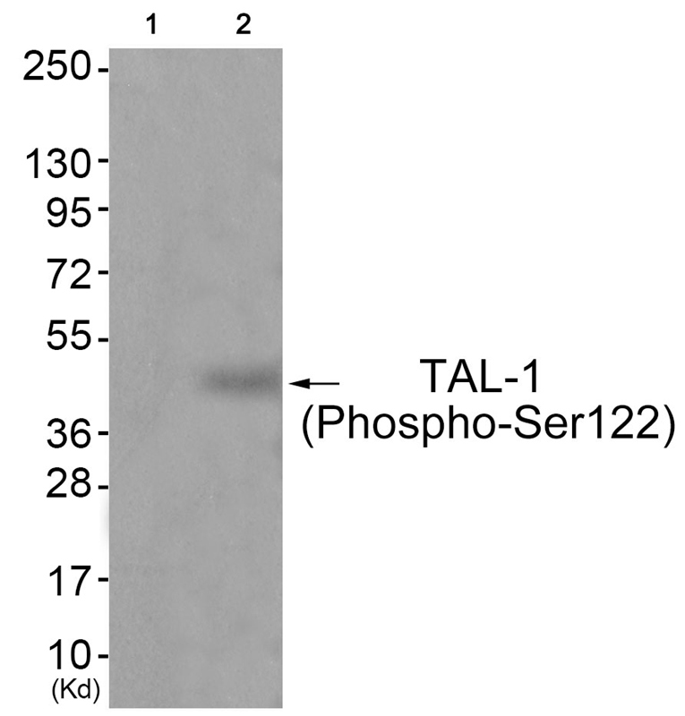 TAL-1 (Phospho-Ser122) Antibod