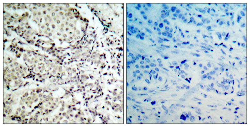 MKK3  Antibody