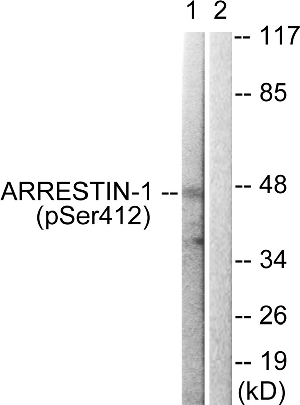 Arrestin 1 (Phospho-Ser412) An