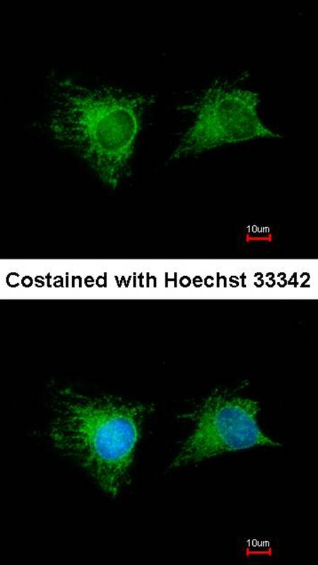 GSTM1 antibody