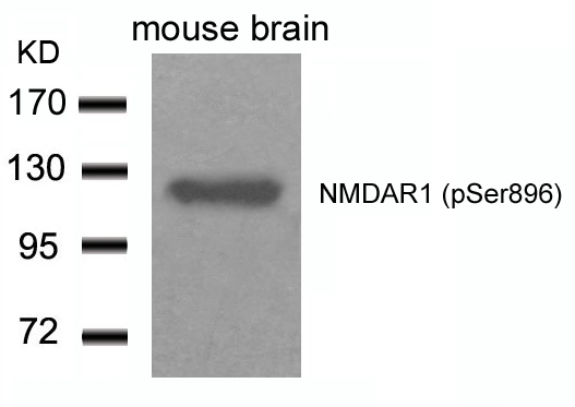 NMDAR1(Phospho-Ser896) Antibod