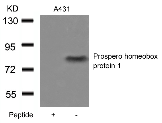 Prospero homeobox protein 1 An