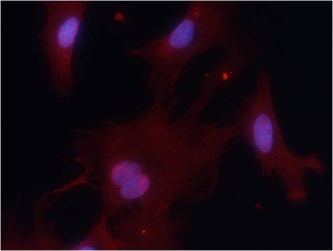 PKM1 Antibody