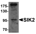 SIK2 Antibody