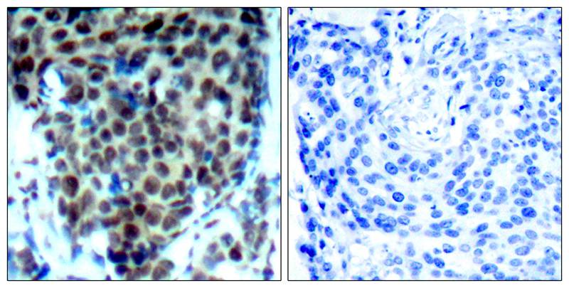 P38 MAPK(Phospho-Thr180) Antib