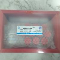 凝血酶原时间(PT)测定试剂盒(冻干型)