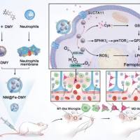 中性粒细胞膜仿生脂质体递送地塞米松和DiR用于炎症部位靶向治疗与成像 DEX/DIR@Liposome@NCM