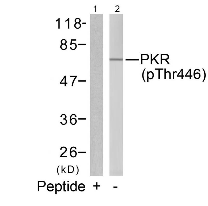PKR(Phospho-Thr446) Antibody