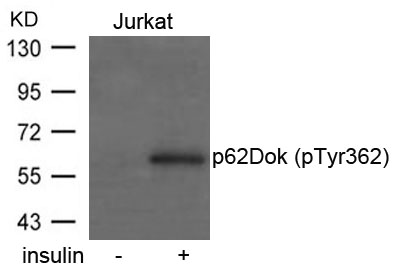 p62Dok(phospho-Tyr362) Antibod