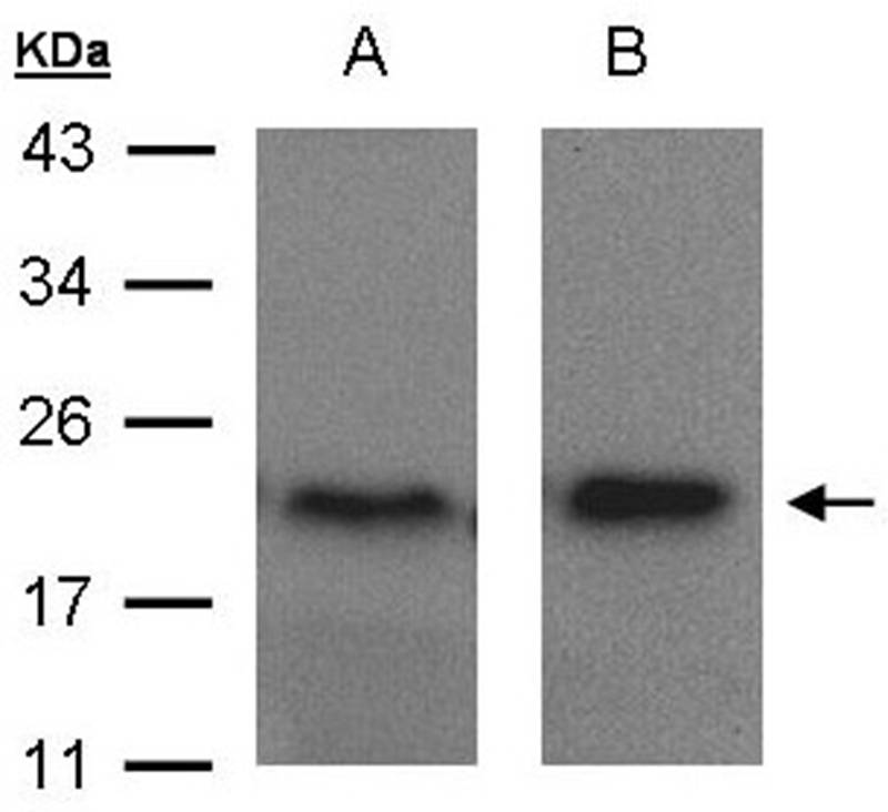 ARF5 antibody