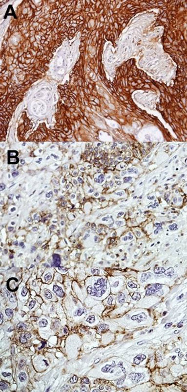 CD44 antigen isoform 4 antibod