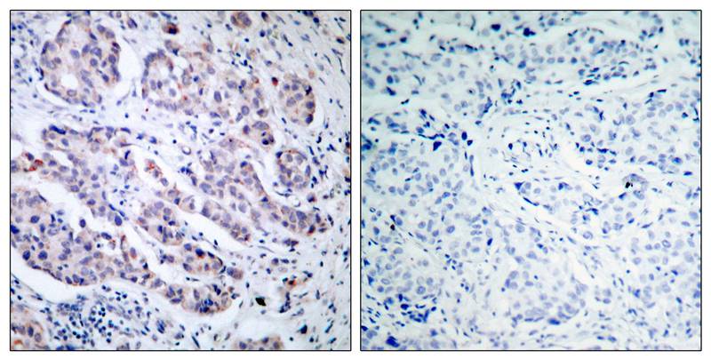 TYK2  Antibody