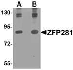 ZFP281 Antibody