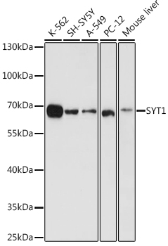 SYT1 Antibody