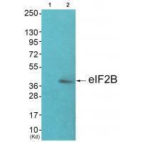 eIF2B   Antibody