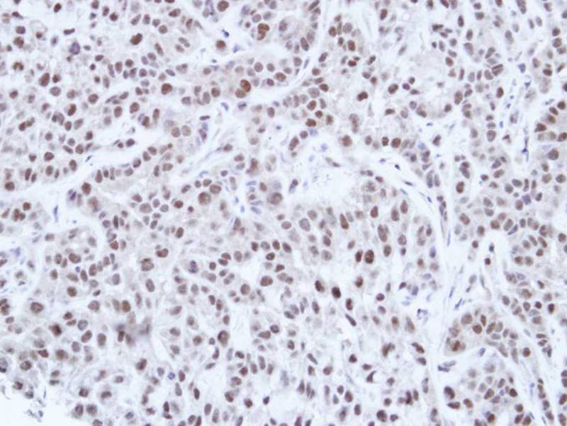 HNF-1 alpha antibody