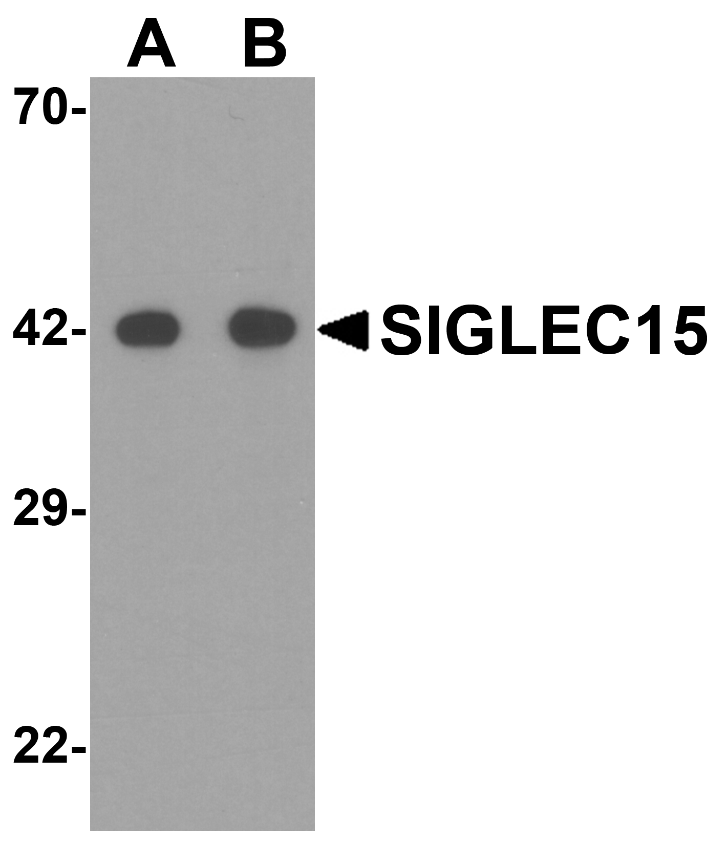 SIGLEC15 Antibody